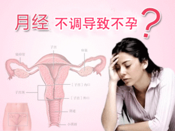 月經(jīng)不調(diào)會(huì)導(dǎo)致不孕嗎   西安安琪兒婦產(chǎn)醫(yī)院