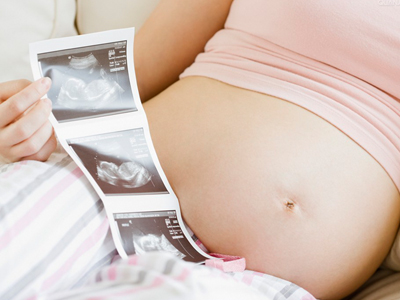 做四維彩超最佳時間