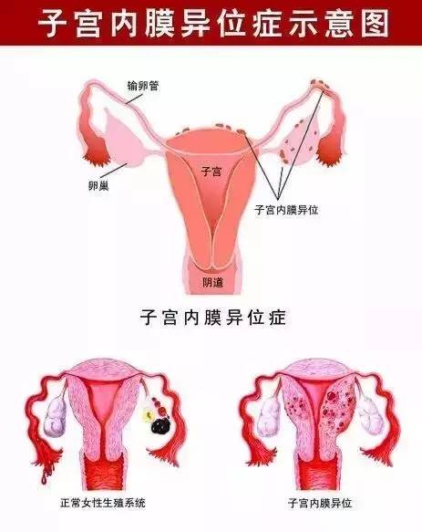 西安安琪兒婦產(chǎn)醫(yī)院