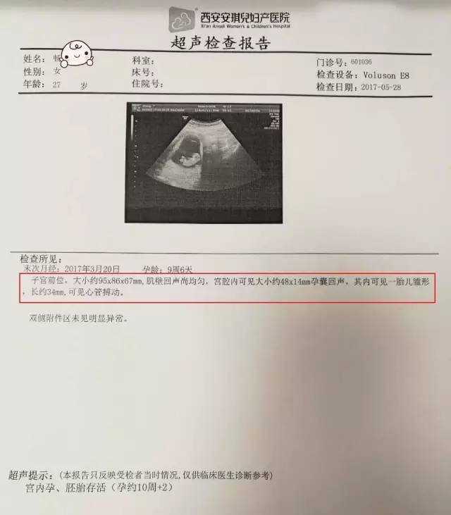 西安安琪兒婦產(chǎn)醫(yī)院