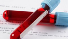 <b>懷孕抽血能檢查出來(lái)嗎？</b>