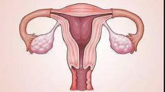 盤點(diǎn)子宮性不孕原因，你是哪一種？